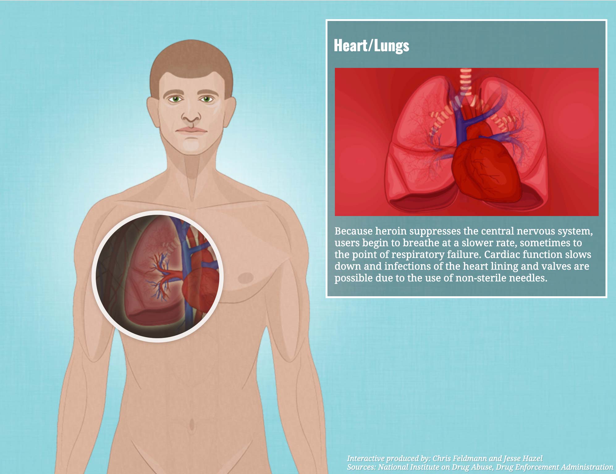 Effects of Heroin 2